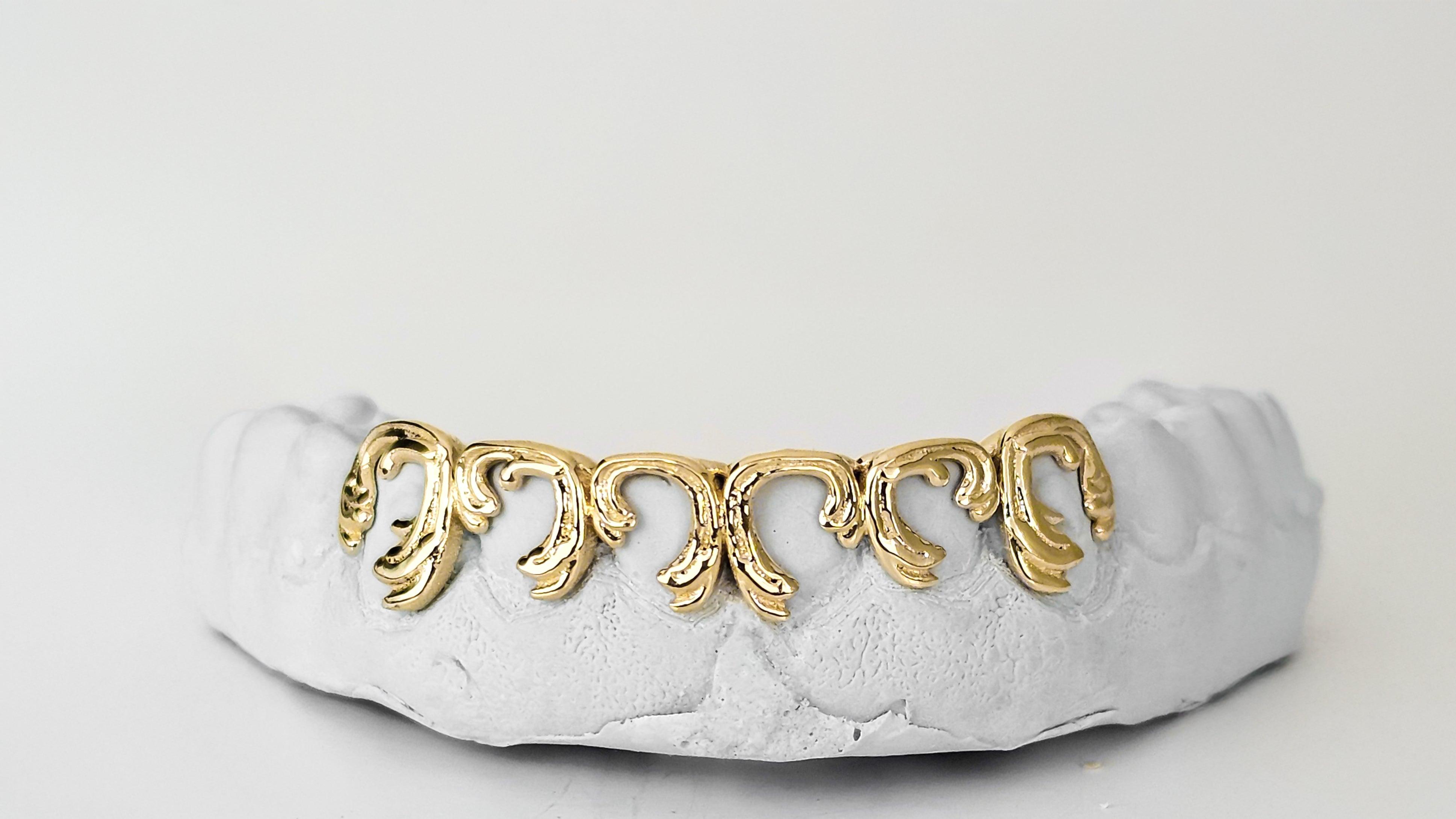 Victorian Scroll Grillz DQ1054