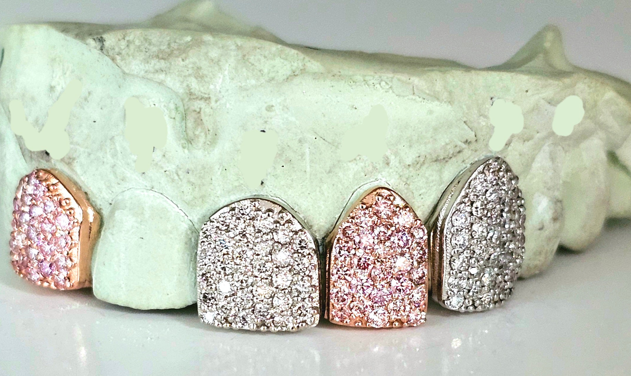 Custom Gemstone Grillz – Premium Gold with Ruby Gemstones DQ1041