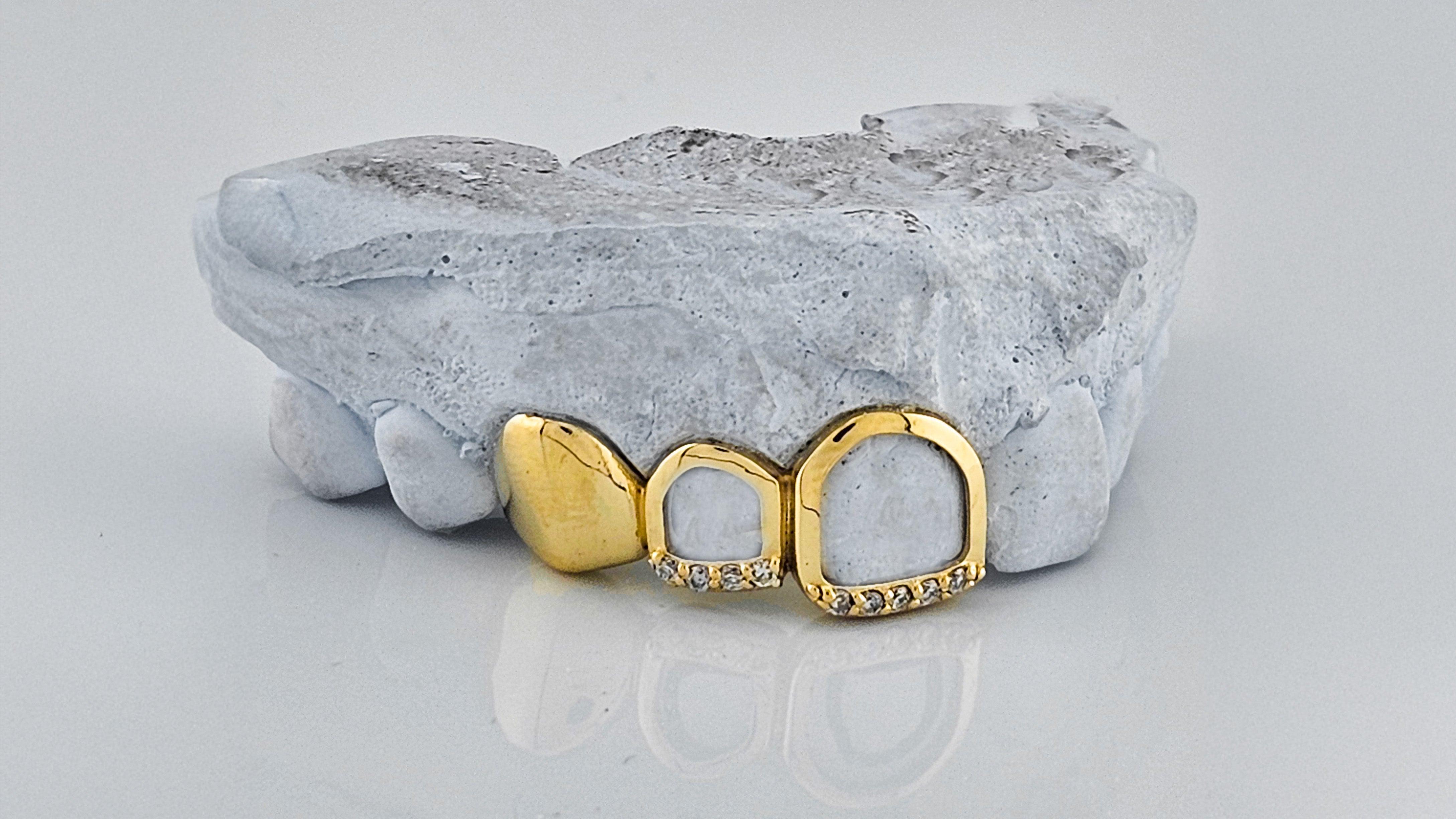 Gold Open Face Grillz Si diamond|1 Solid Tooth Gold Teeth America