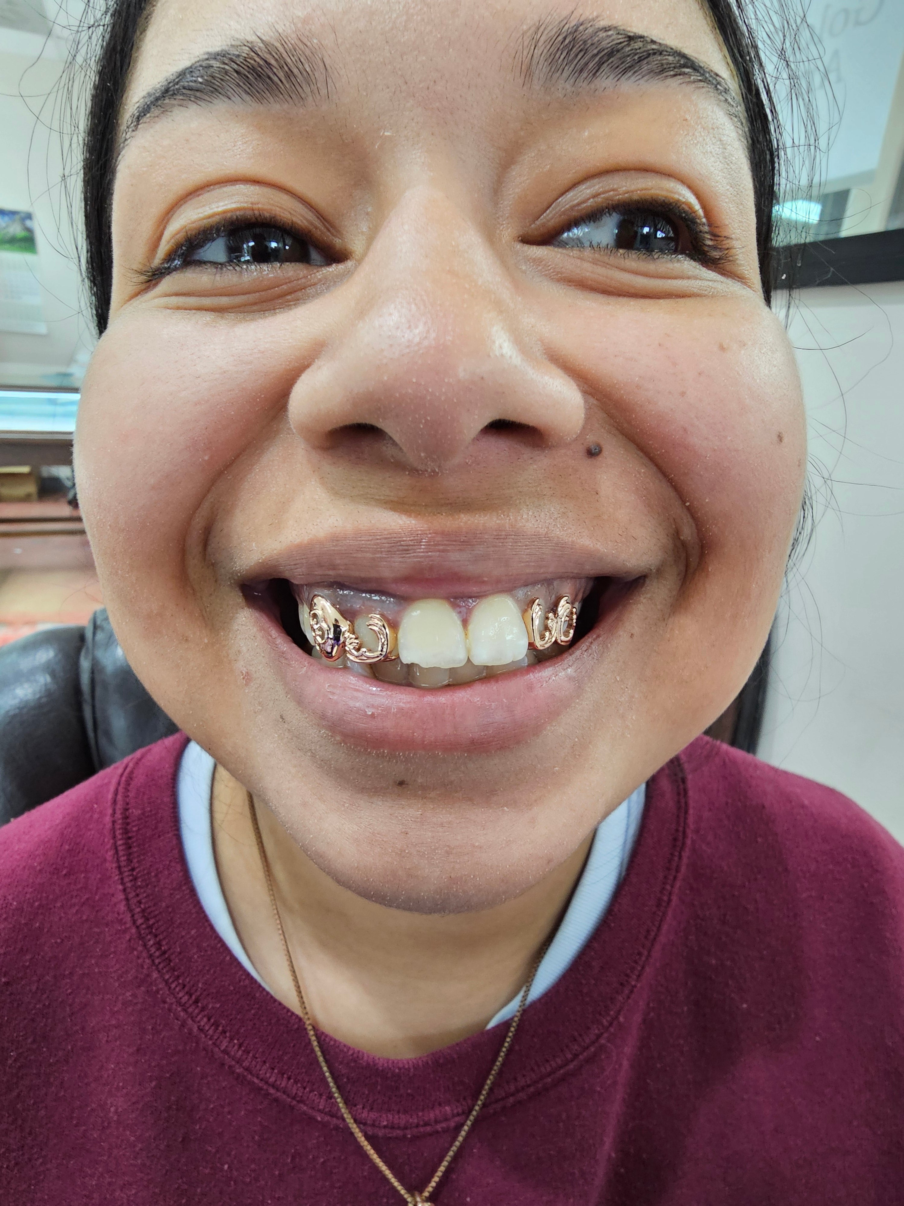 Victorian Scroll Grillz DQ1054
