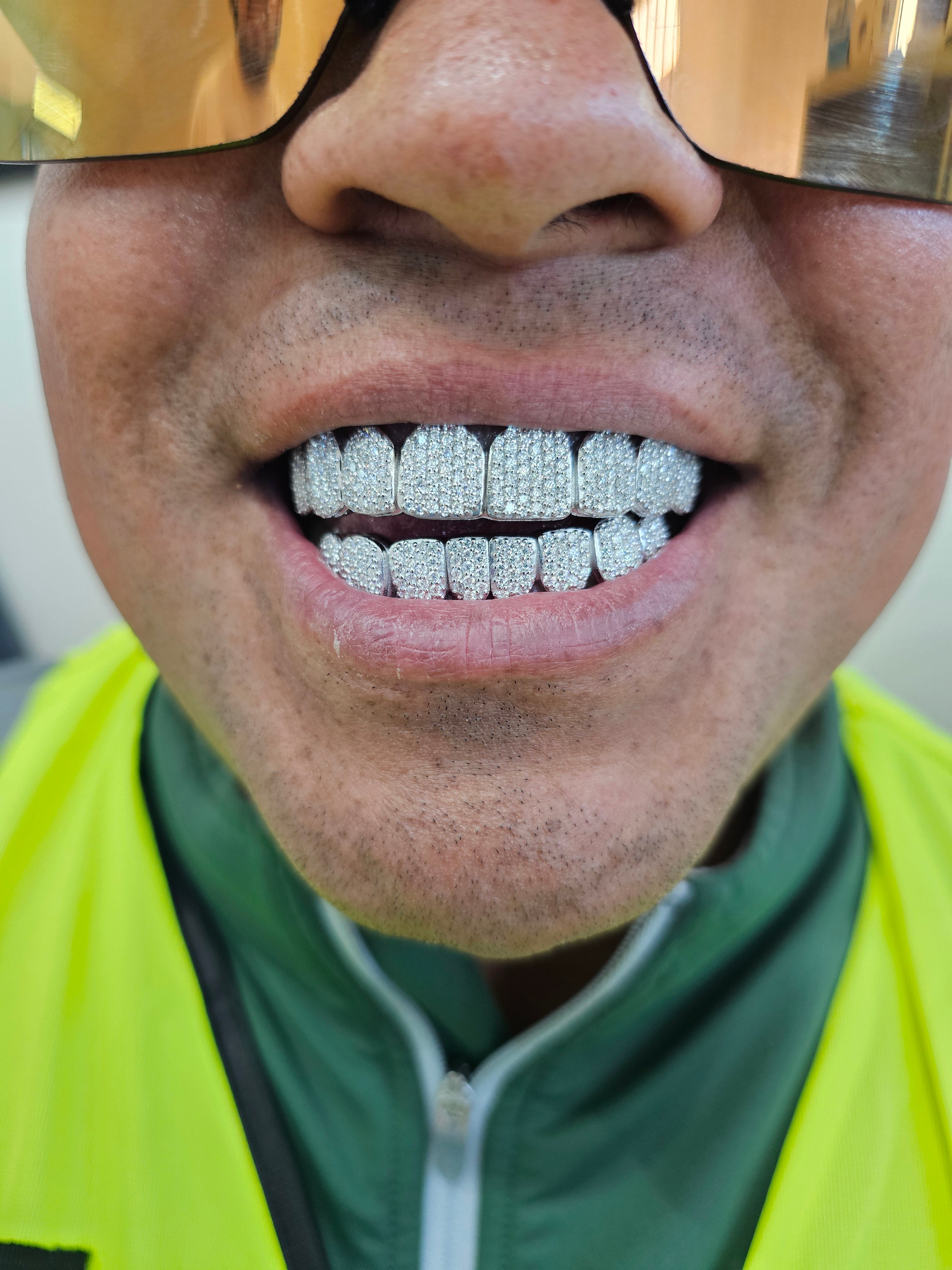Moissanite VVS Quality Iced Out Grillz - DQ1002