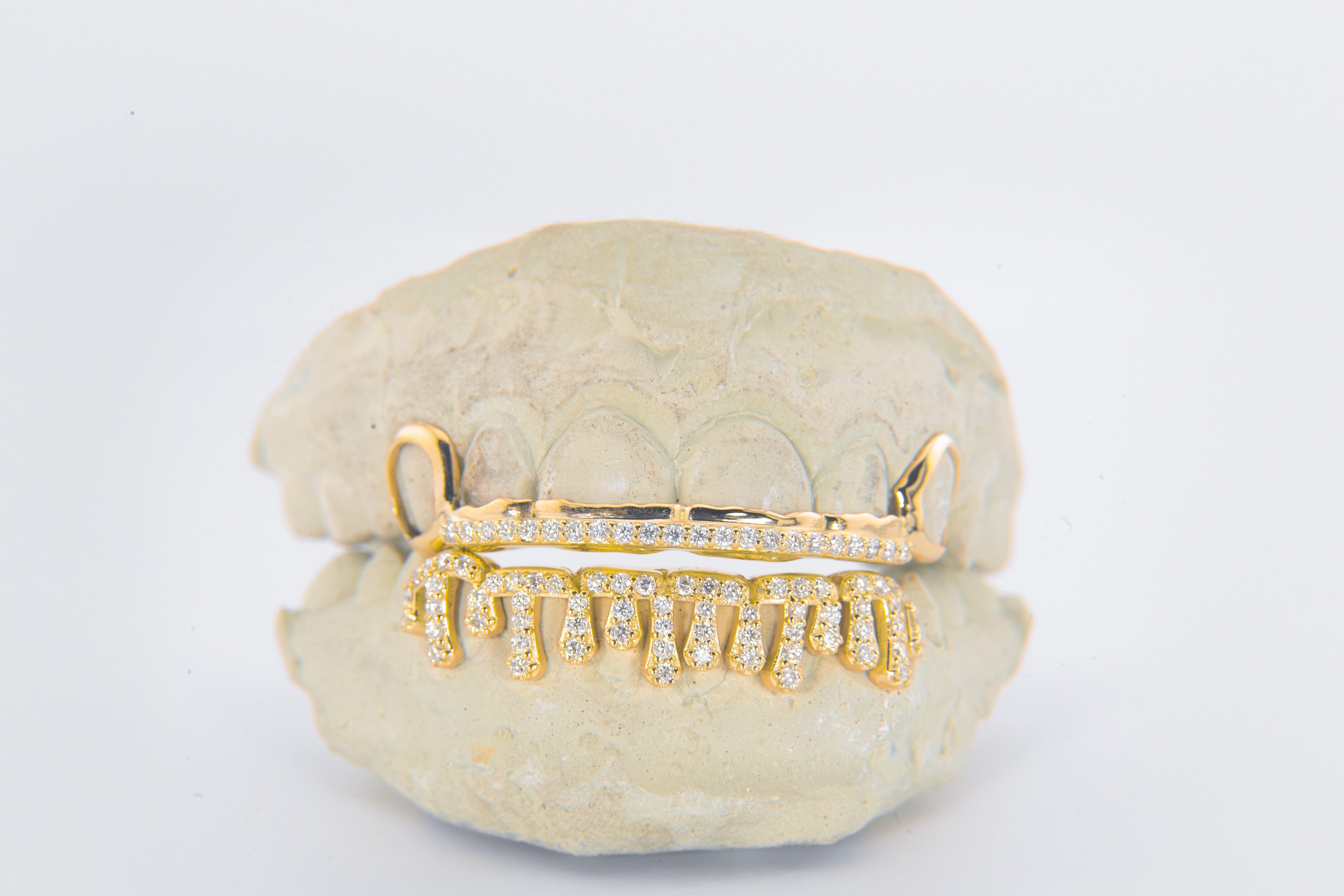 Alexis Edition Moissanite Gold Grillz – Drip & Rail Combo Now Available! DQ1059