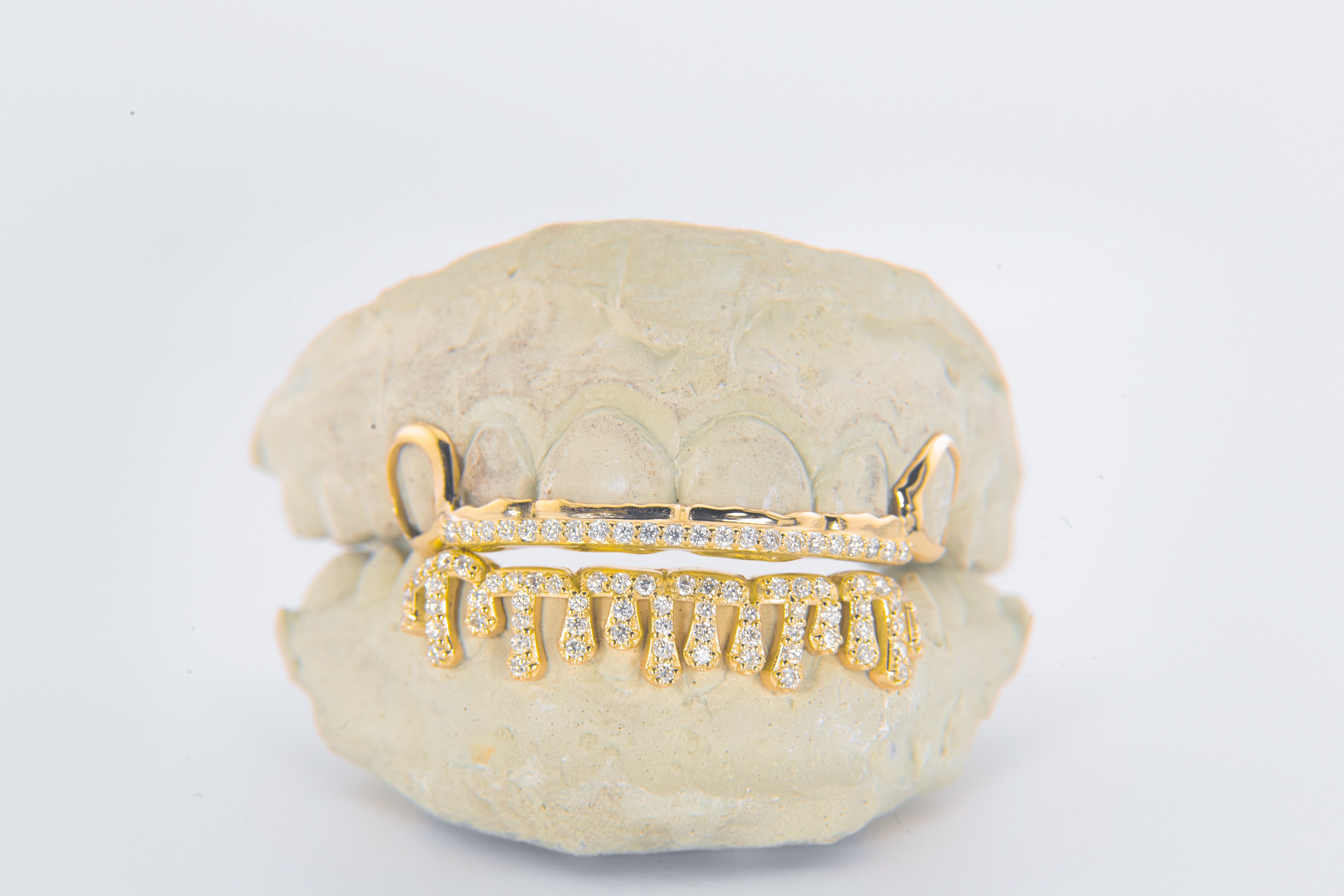Silver Moissanite Drip Grillz 6pc DQ1053