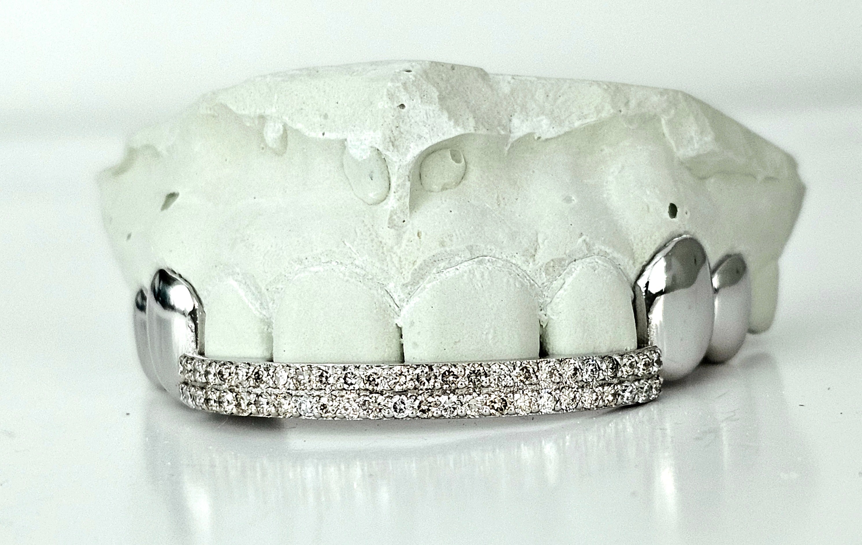Silver Moissanite Double Bar Grillz DQ1052