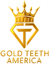 Gold Teeth America