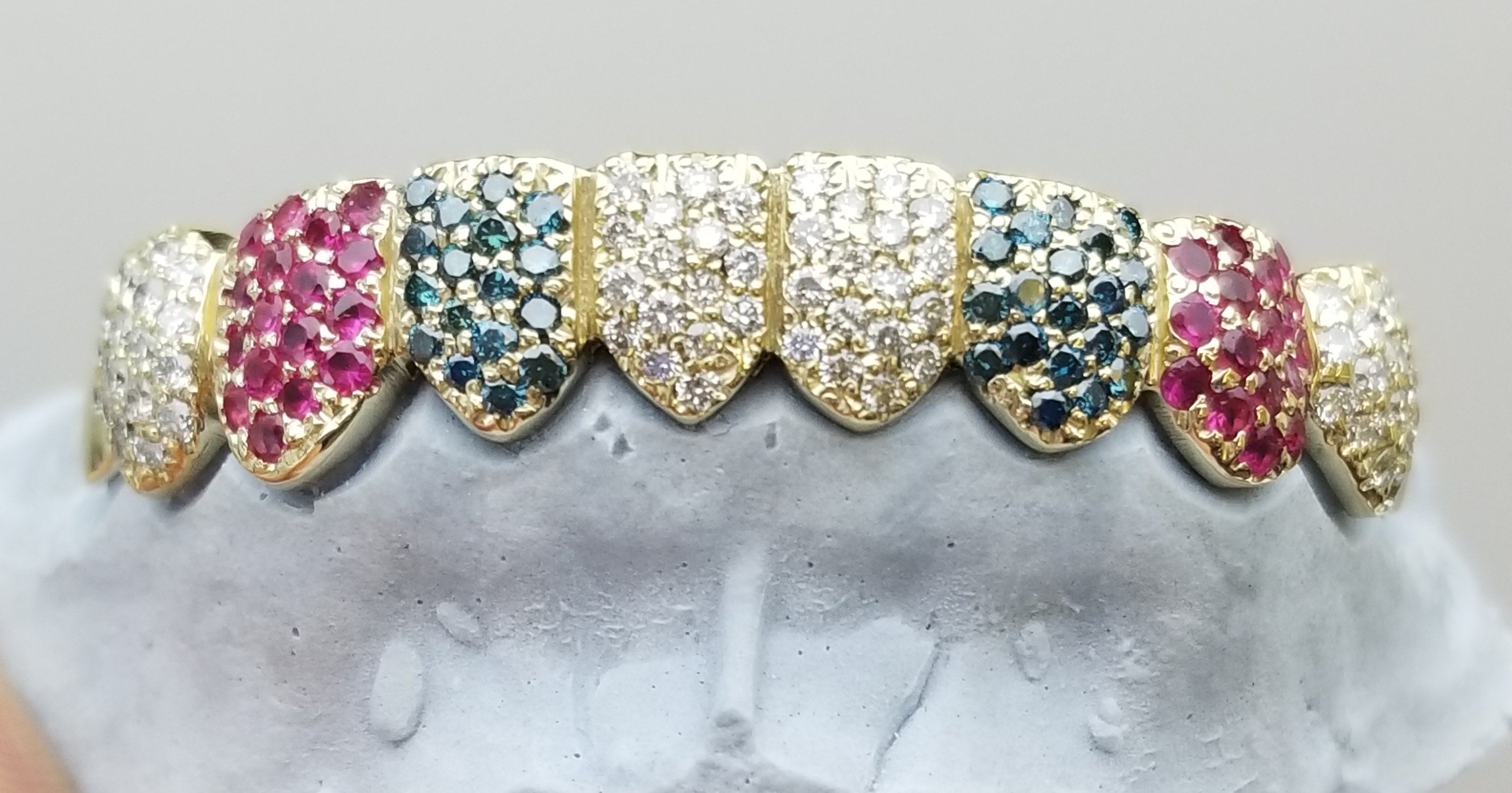 Custom Gemstone Grillz – Premium Gold with Ruby Gemstones DQ1041