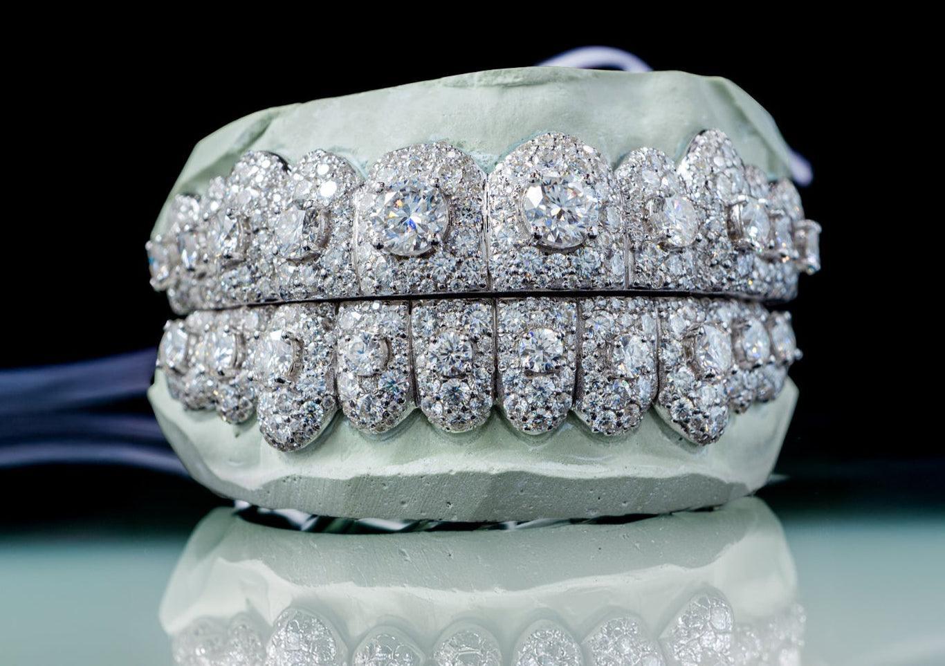 Moissanite Honeymoon Set Grillz DQ1057