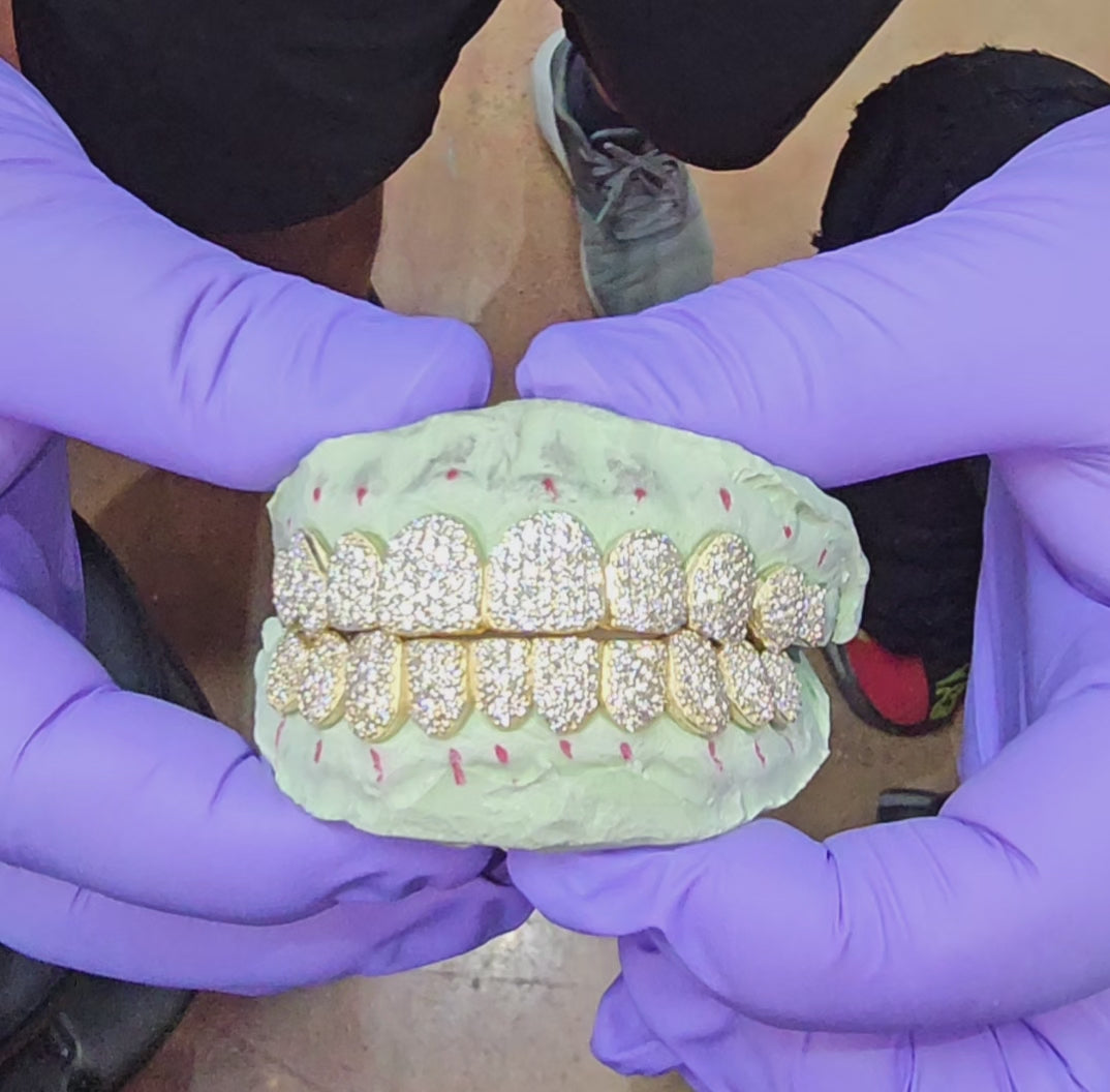 VVS Natural Diamond Honeycomb Set Grillz: Luxury for Your Smile DQ1043