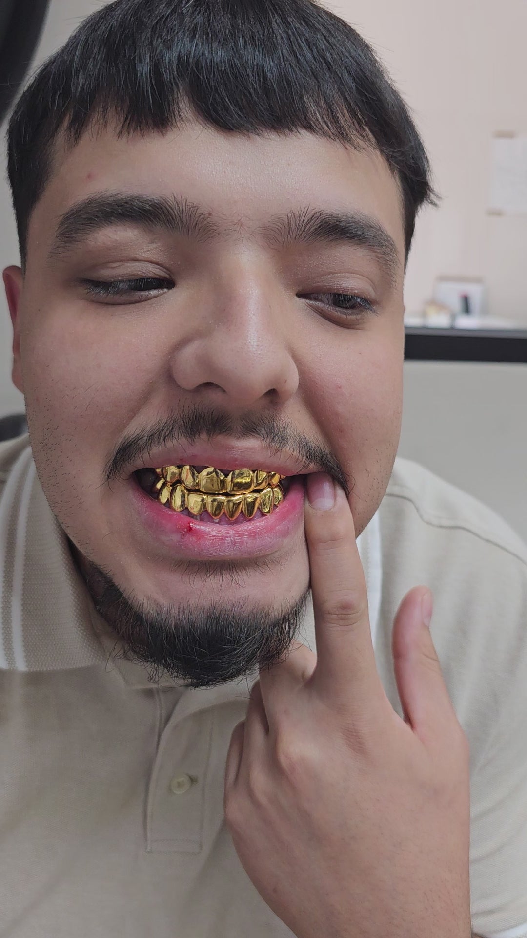 Dental Gold Grillz - NPG or 8K Gold Grillz