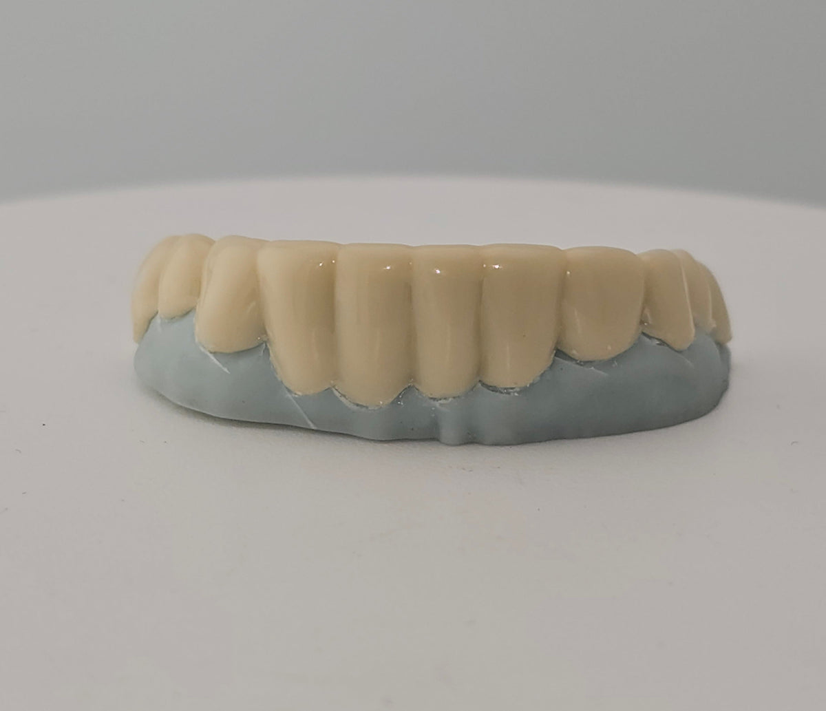 Pop-On Veneer