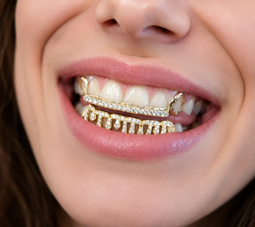 Grillz for Women