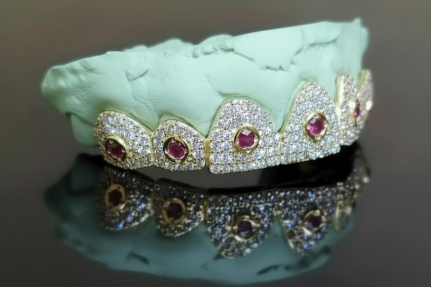 Cosmic Crown Grillz – Ruby Orbit Edition 6 or 12 Set - DQ1010