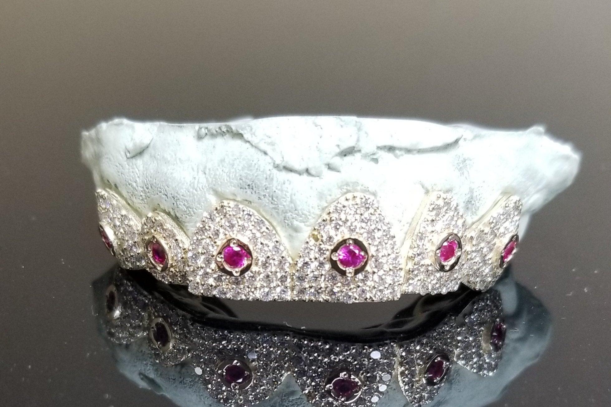 Cosmic Crown Grillz – Ruby Orbit Edition 6 or 12 Set