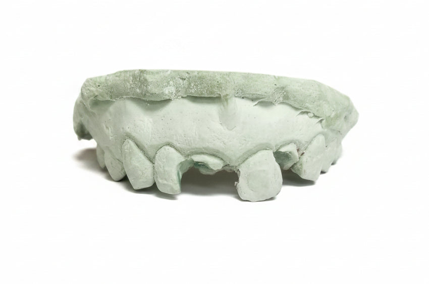 Gold Grillz With Missing Teeth - DQ1001 MT