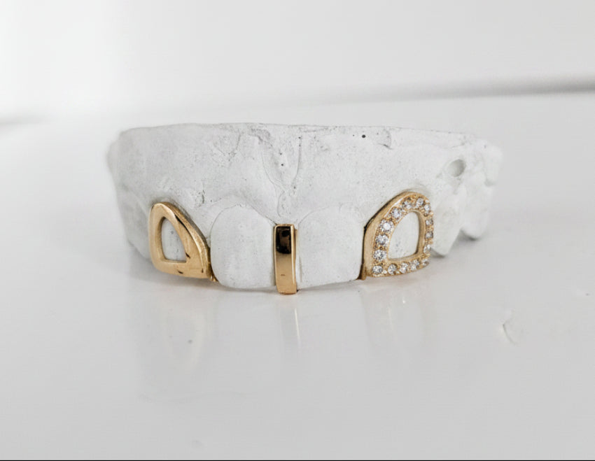 Diamond Strip | Gap Filler Set | 2 Solid Gold DQ1045