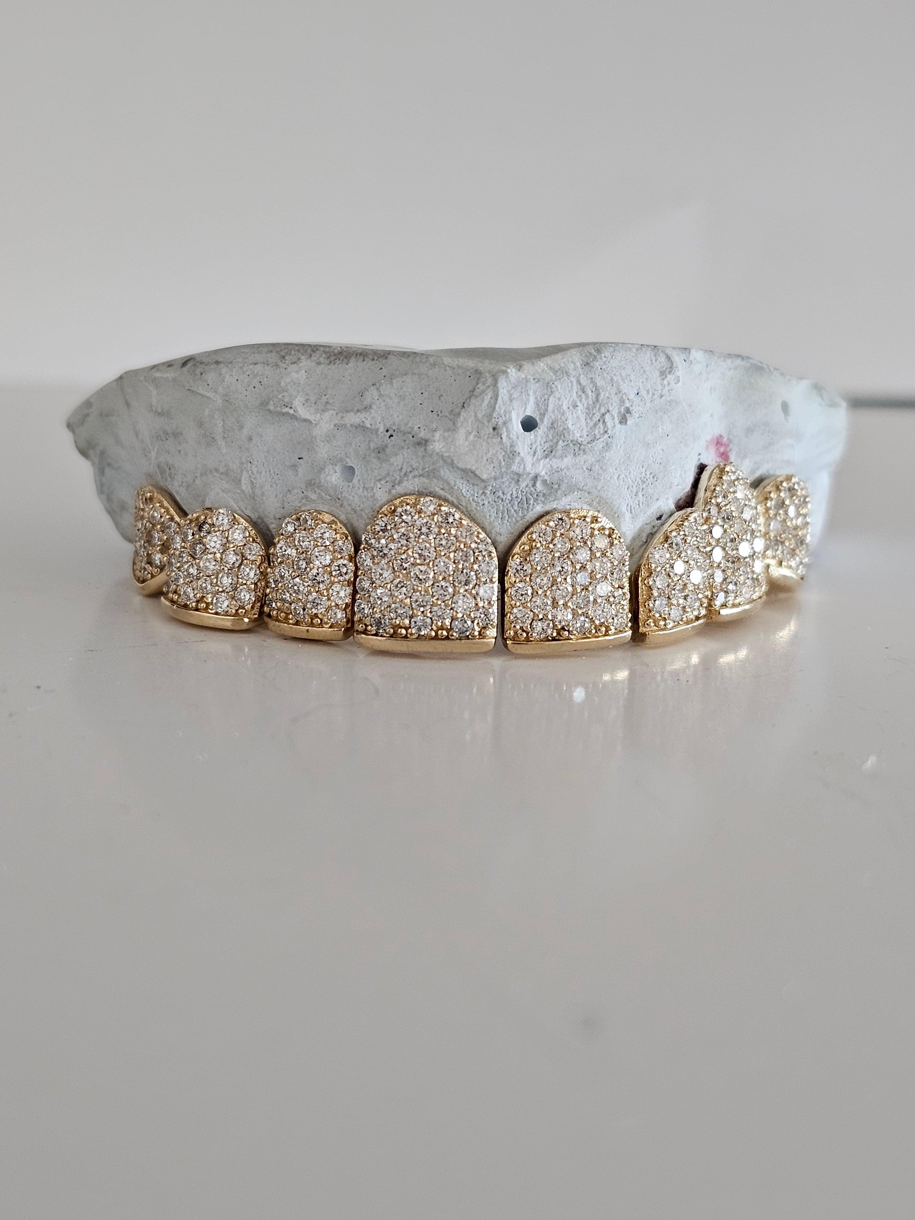 Gold Permanent Teeth DQ1023 Gold Teeth America