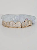 Gold Permanent Teeth - Gold Teeth America