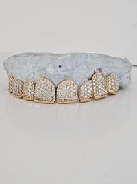 Gold Permanent Teeth - Gold Teeth America