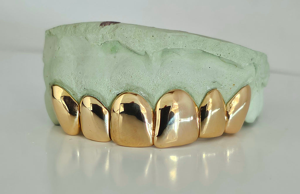 Permanent Gold Crown DQ1023