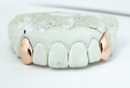 2 Set Fang Grillz - DQ1009