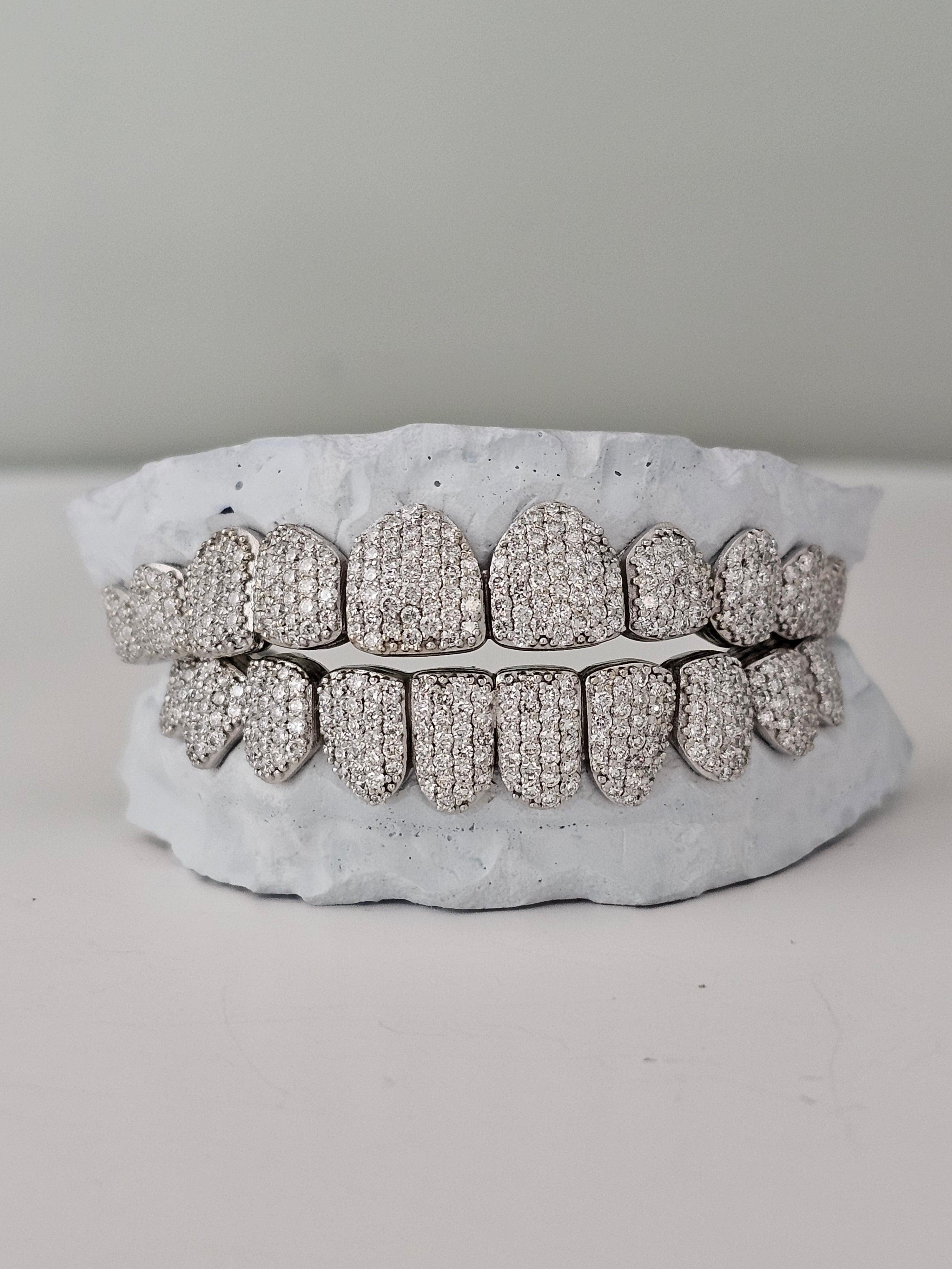 Gold Permanent Teeth - Gold Teeth America