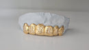 Gold Grillz with Diamond-Cut Engraving