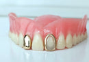 Grillz on Your Denture - DQ1023DNT
