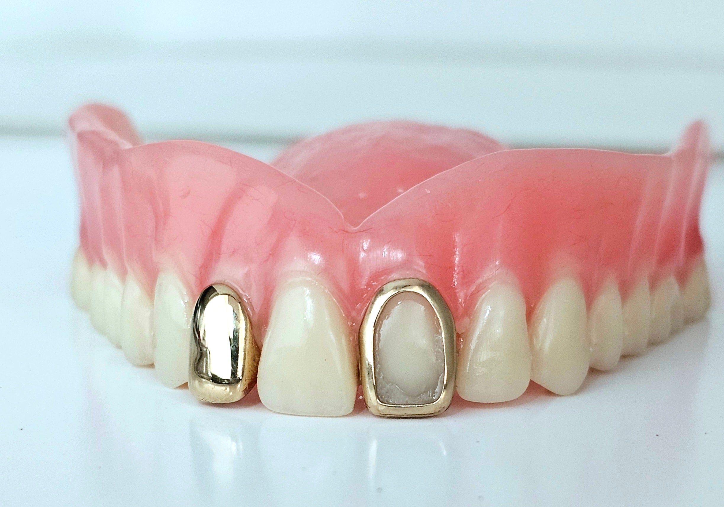 Grillz on Your Denture - DQ1023DNT