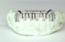 Alexis Edition Moissanite Gold Grillz – Drip & Rail Combo Now Available! DQ1059