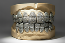 Hybrid Moissanite Grillz