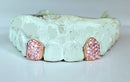 Custom Gemstone Grillz – Premium Gold with Ruby Gemstones DQ1041