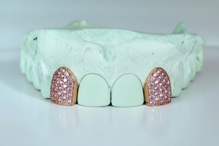 Custom Gemstone Grillz – Premium Gold with Ruby Gemstones DQ1041