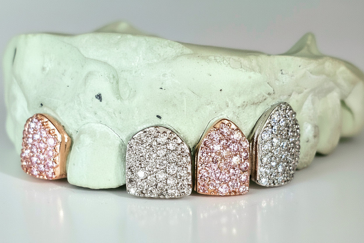 Custom Gemstone Grillz – Premium Gold with Ruby Gemstones DQ1041