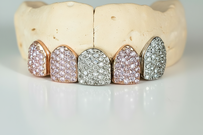 Luxury Multi-Stone Iced-Out Grillz-  DQ1019