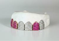 Custom Gemstone Grillz – Premium Gold with Ruby Gemstones DQ1041