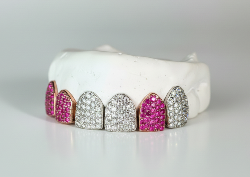 Custom Gemstone Grillz – Premium Gold with Ruby Gemstones DQ1041