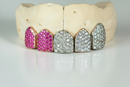 Luxury Multi-Stone Iced-Out Grillz-  DQ1019