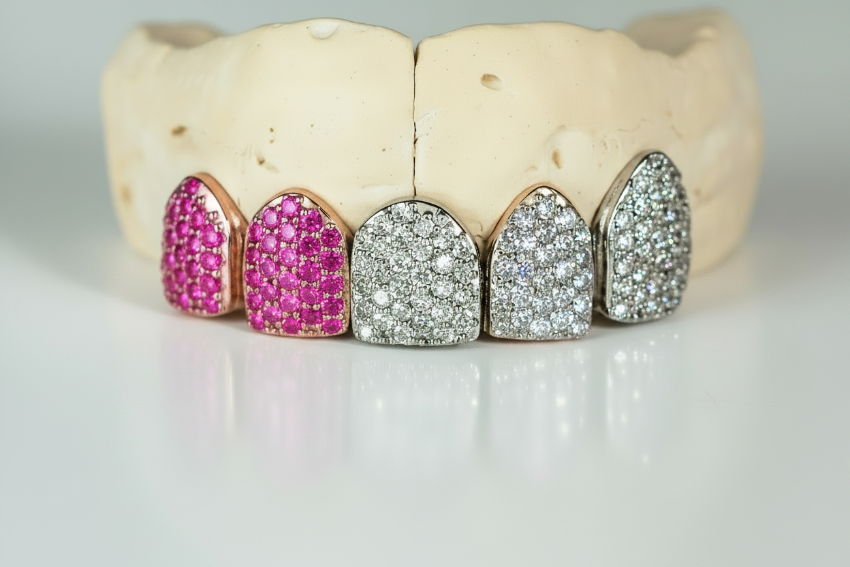 Luxury Multi-Stone Iced-Out Grillz-  DQ1019