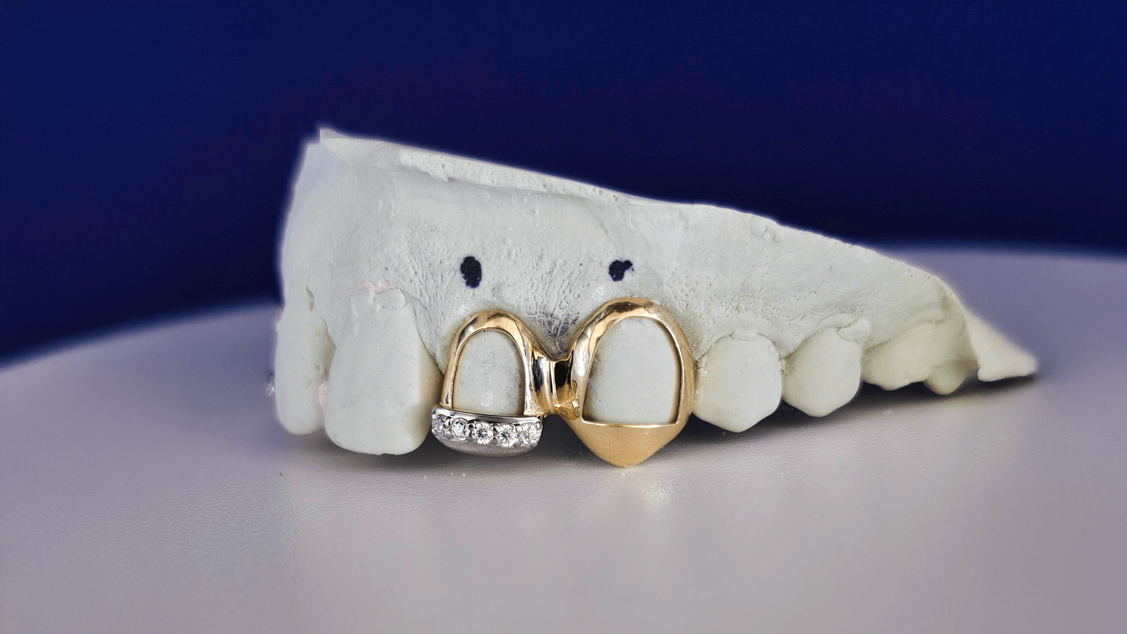 Royal Glow Open-Face Grillz | Si Diamond