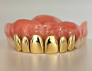 Gold Permanent Teeth - Gold Teeth America