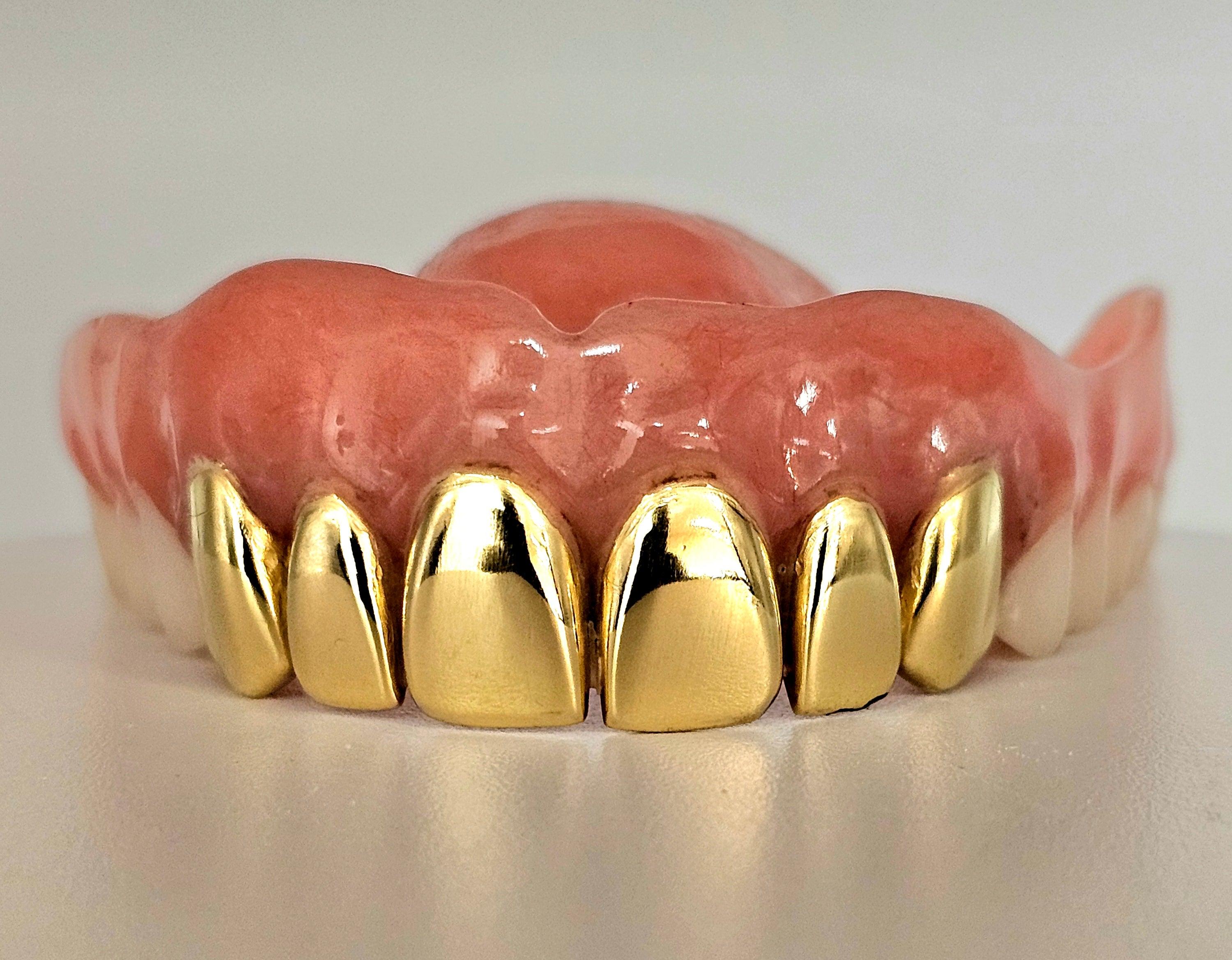 Gold Permanent Teeth - Gold Teeth America