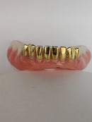 Gold Permanent Teeth - Gold Teeth America