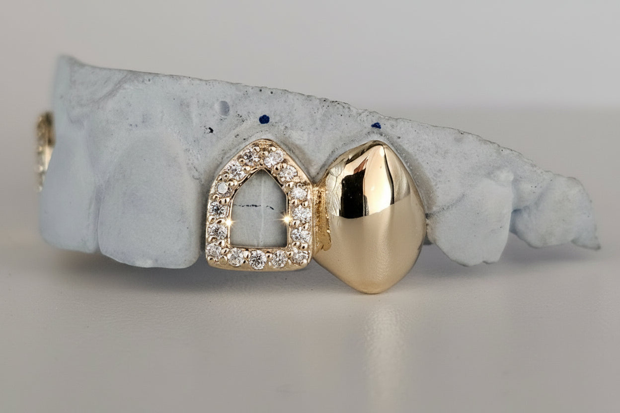 Diamond Frame Gold Grillz DQ1032