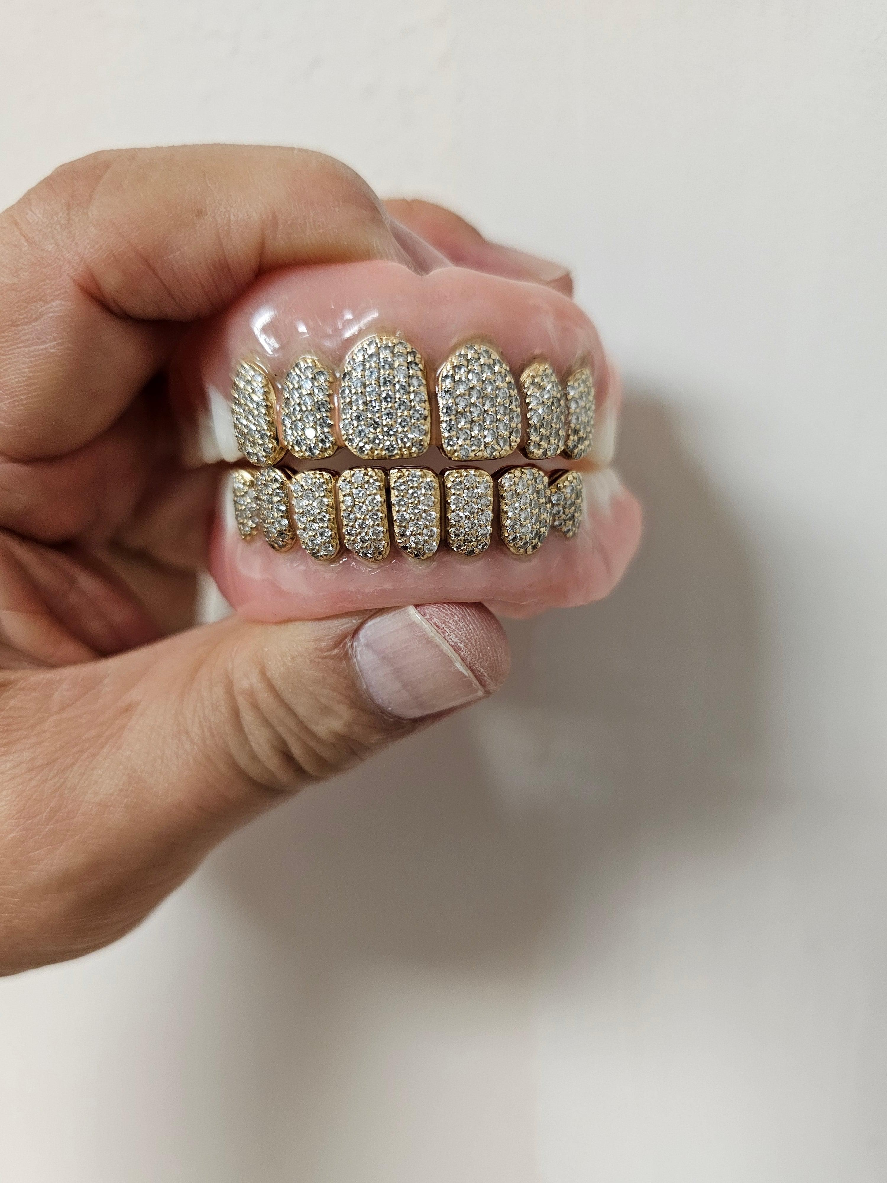 Gold Permanent Teeth - Gold Teeth America