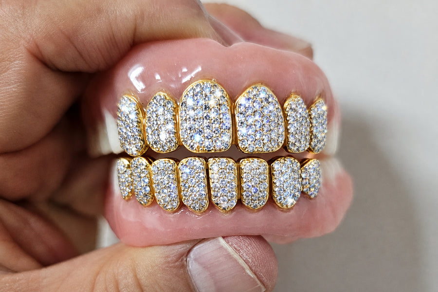 Grillz on Your Denture - DQ1023DNT