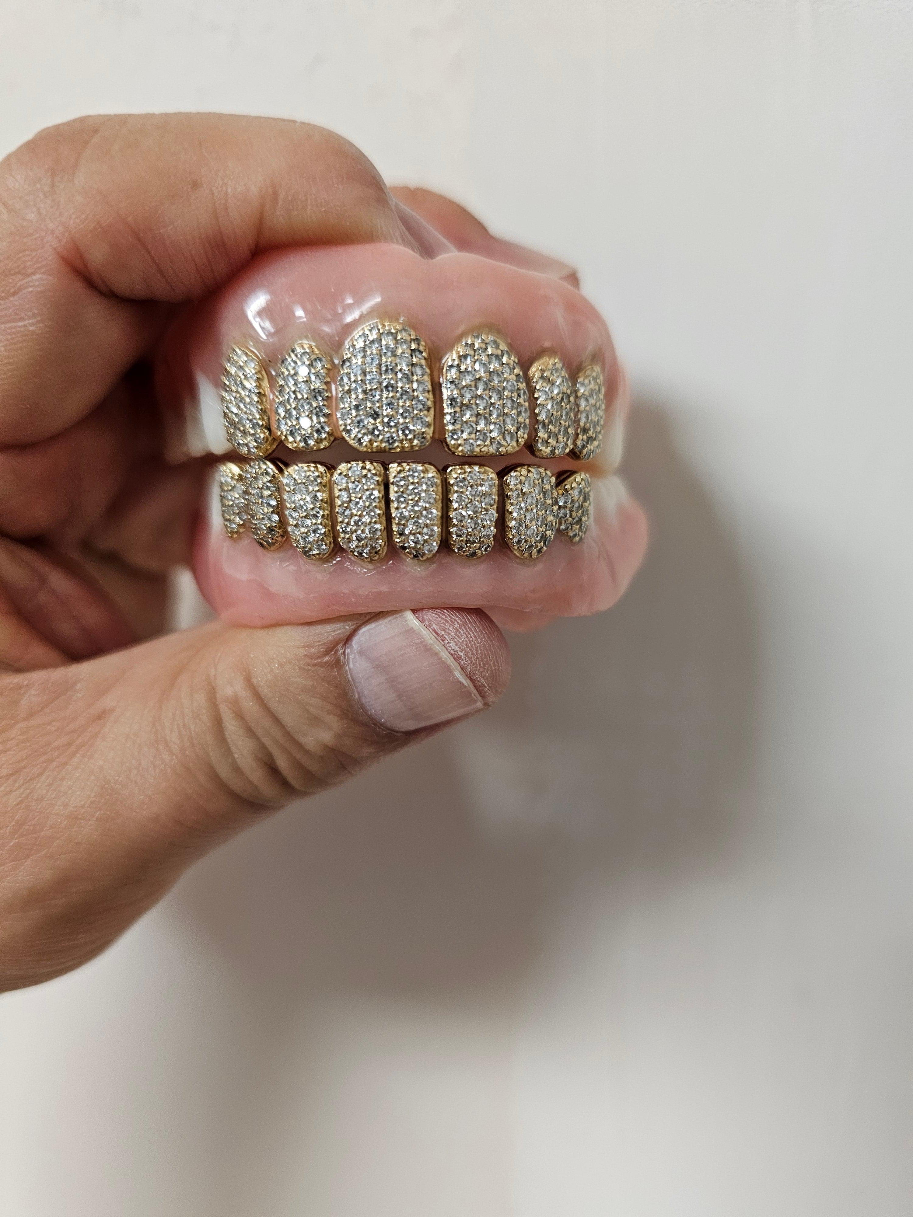 Gold Permanent Teeth - Gold Teeth America