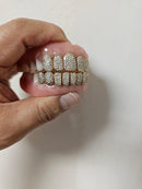 Gold Permanent Teeth - Gold Teeth America