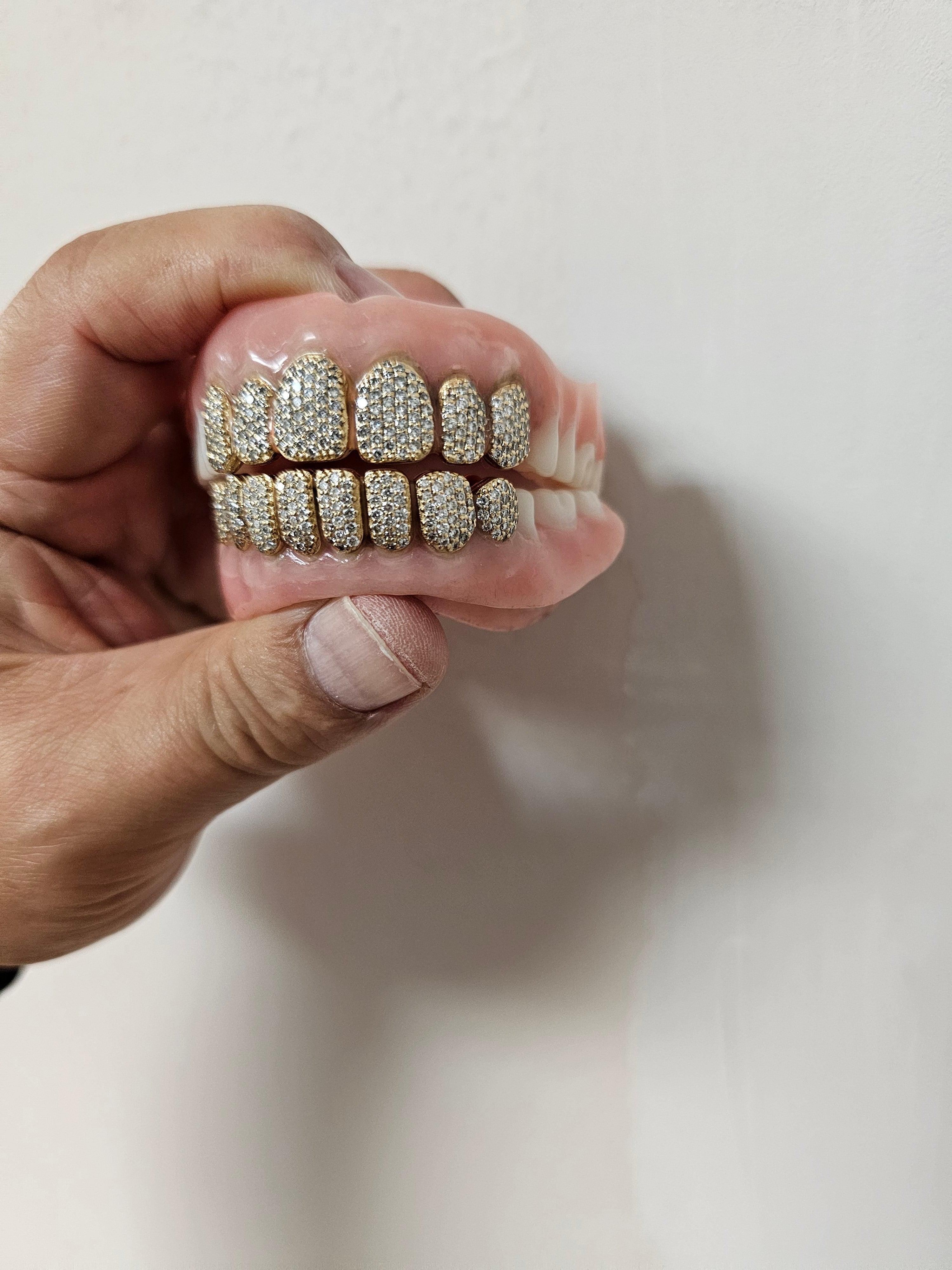 Gold Permanent Teeth - Gold Teeth America