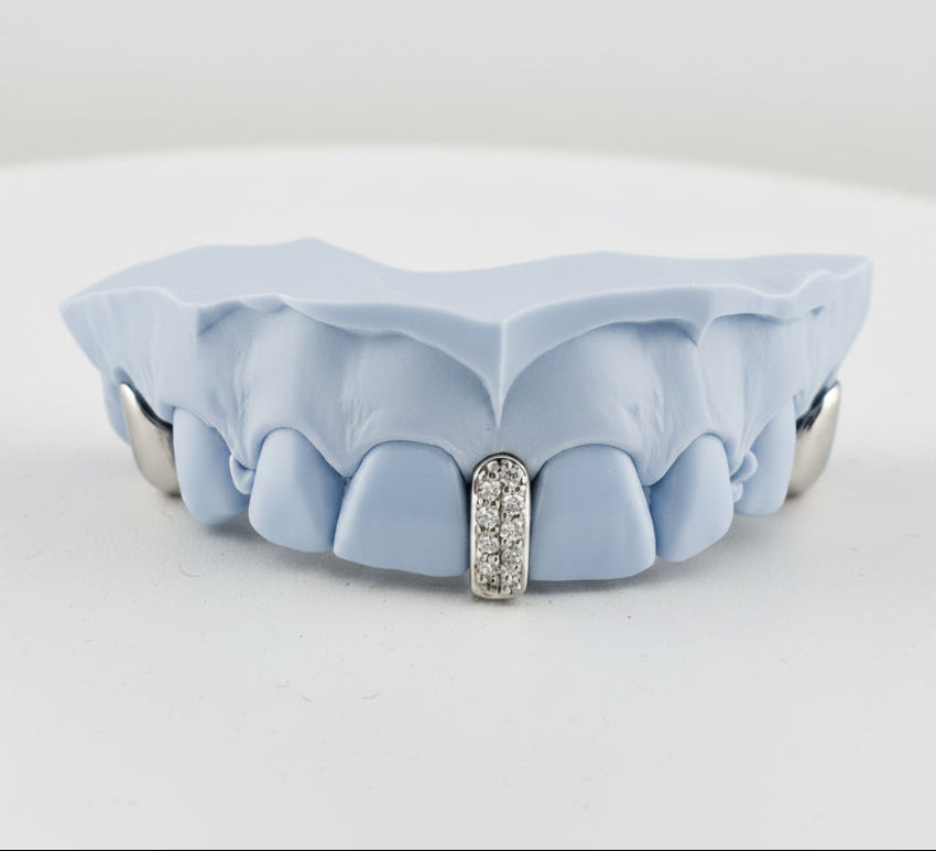 Diamond Strip | Gap Filler Set | 2 Solid Gold DQ1045