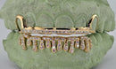 Alexis Edition Moissanite Gold Grillz – Drip & Rail Combo Now Available! DQ1059